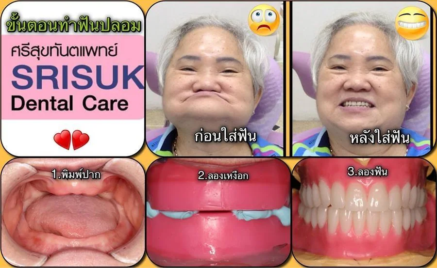 ฟันปลอม 3