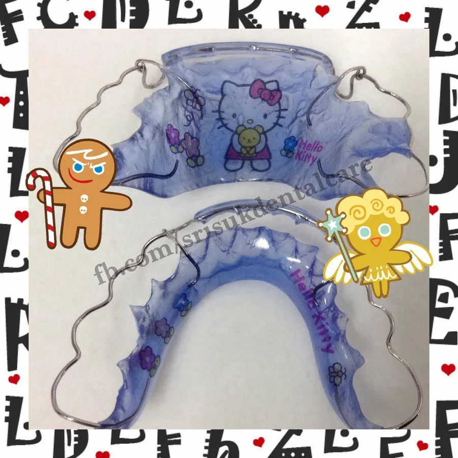 รีเทนเนอร์ 2