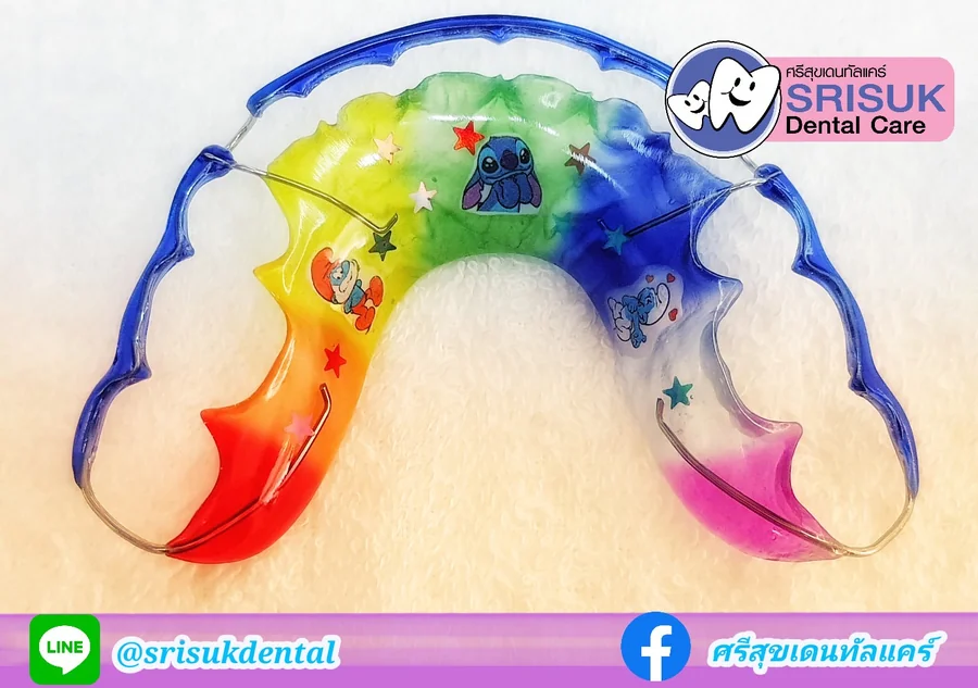 รีเทนเนอร์ 3