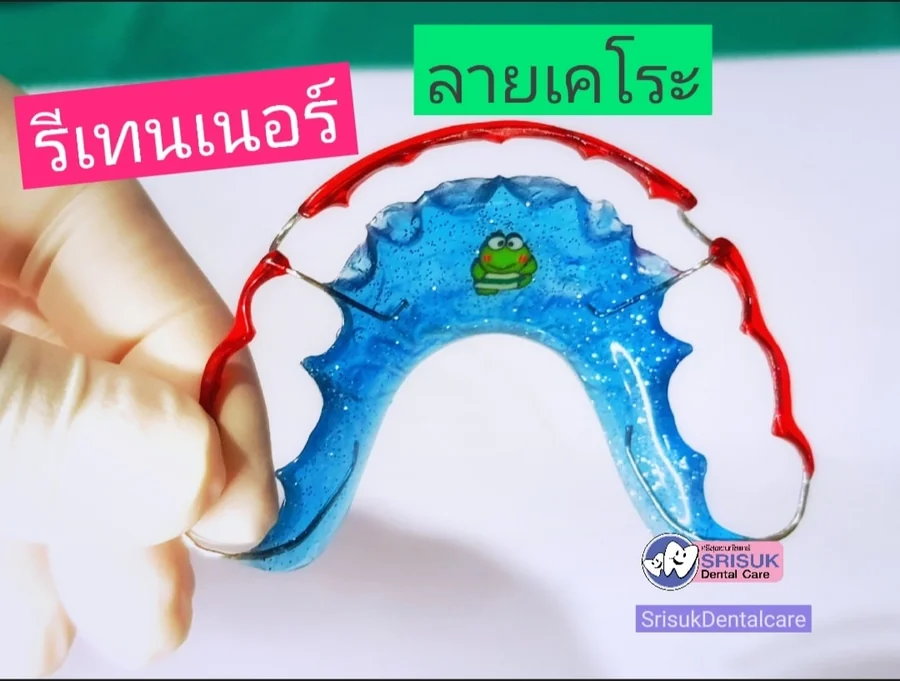 รีเทนเนอร์ 5