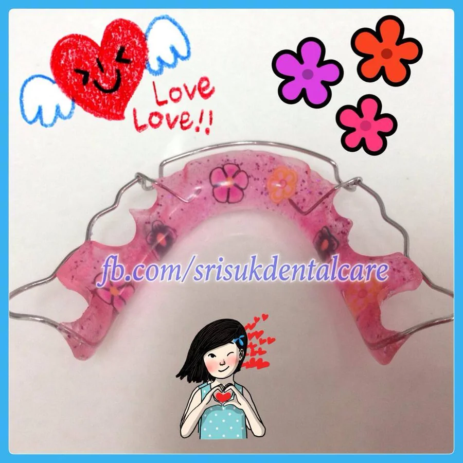 รีเทนเนอร์ 6