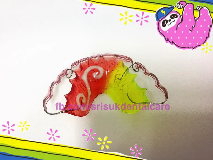 รีเทนเนอร์ 11