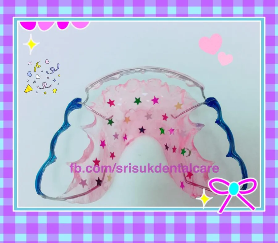 รีเทนเนอร์ 12