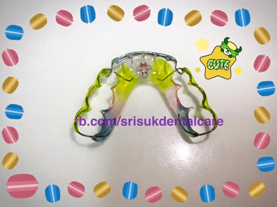 รีเทนเนอร์ 13