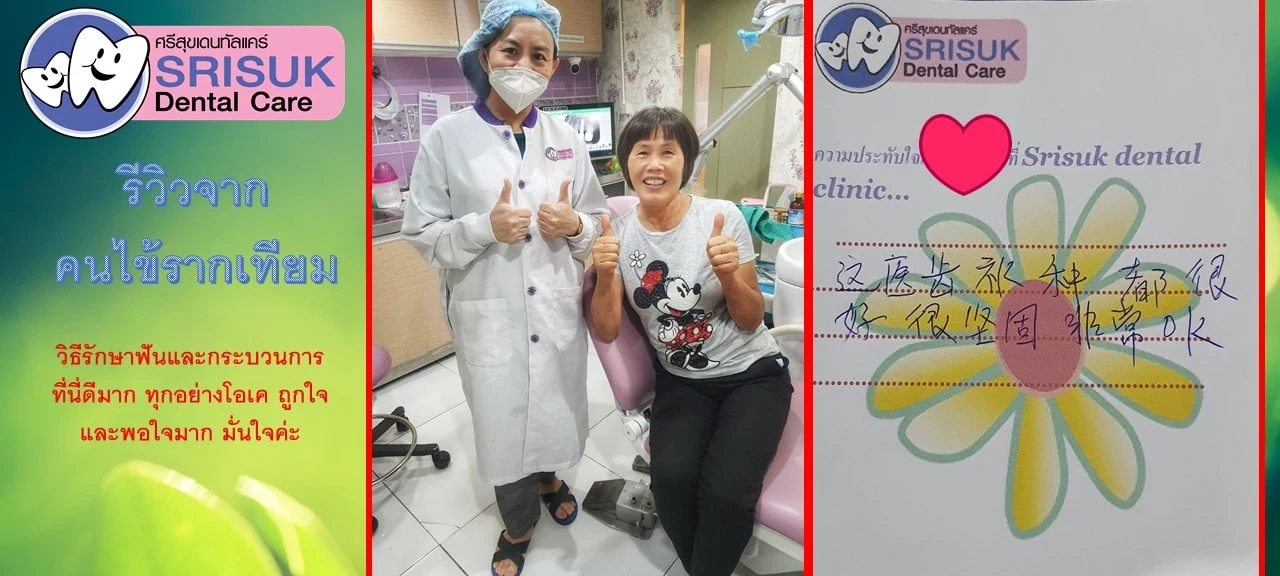 รีวิวรากฟันเทียม คนไข้จริง